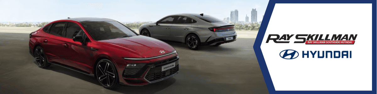 cars buy vs lease - blog - Should You Buy or Lease Your Next Car - banner